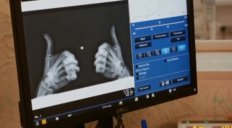 «Работа не волк»: опасен ли рентген и прочие секреты работы рентгенолога